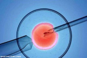 好孕案例